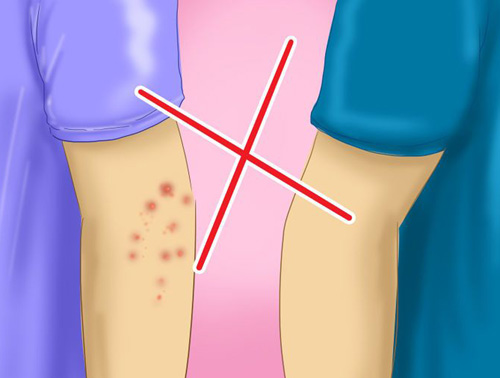 PARTISTA DE CONTACTO