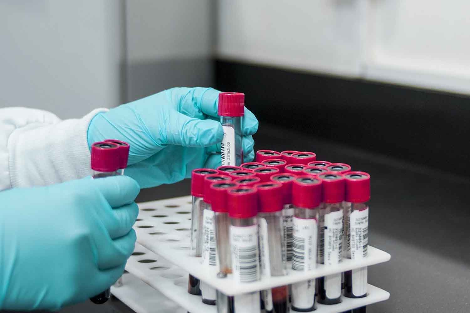 analisi del sangue
