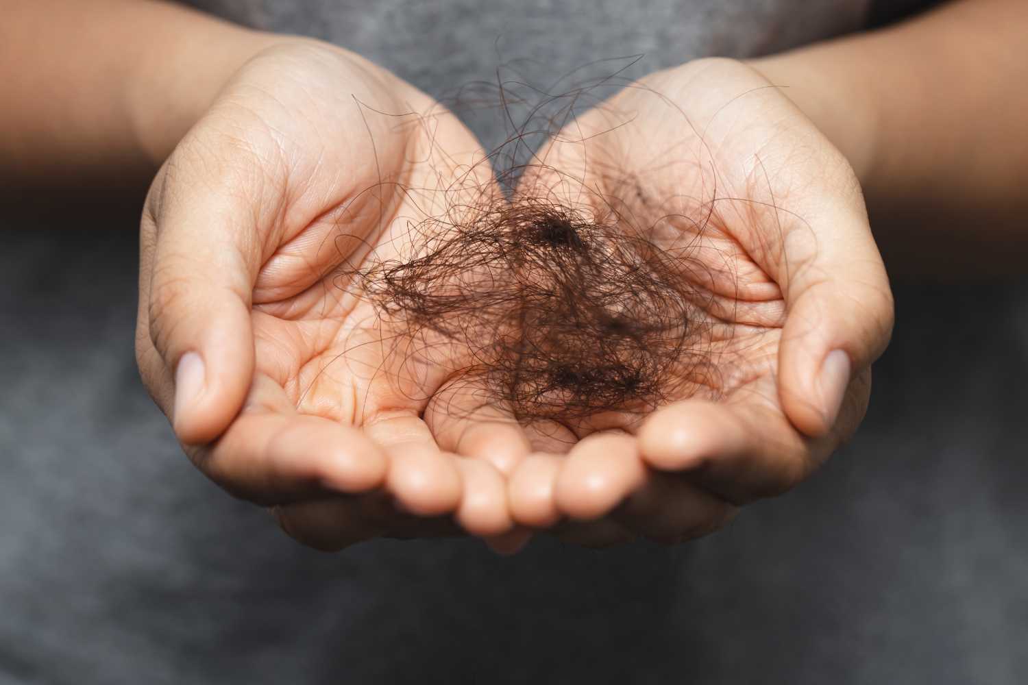 pérdida de cabello