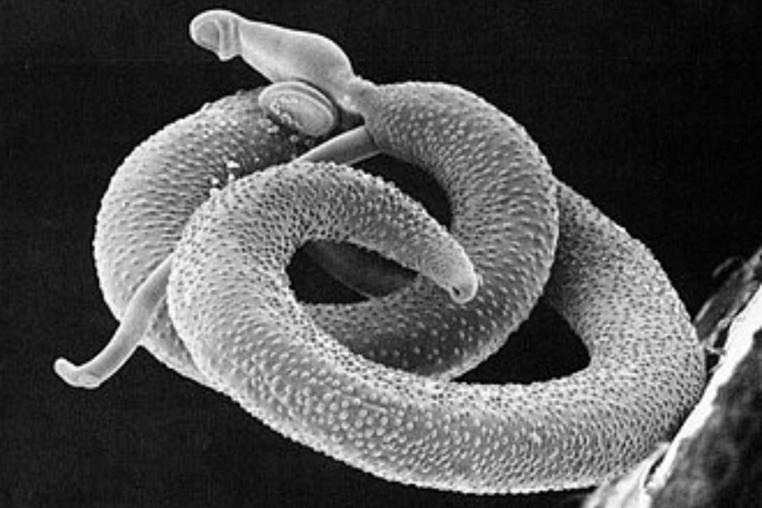 Schistosoma mansoni
