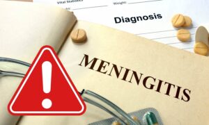Brote de meningitis en el Reino Unido, los casos aumentan a 27: ¿cuáles son los riesgos para Italia y Europa?