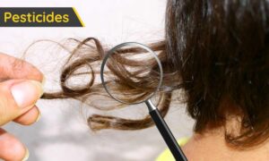 Pesticidas en el pelo de 52 de 54 personas: todos estamos expuestos, incluso en casa (cuidado con los antimosquitos)