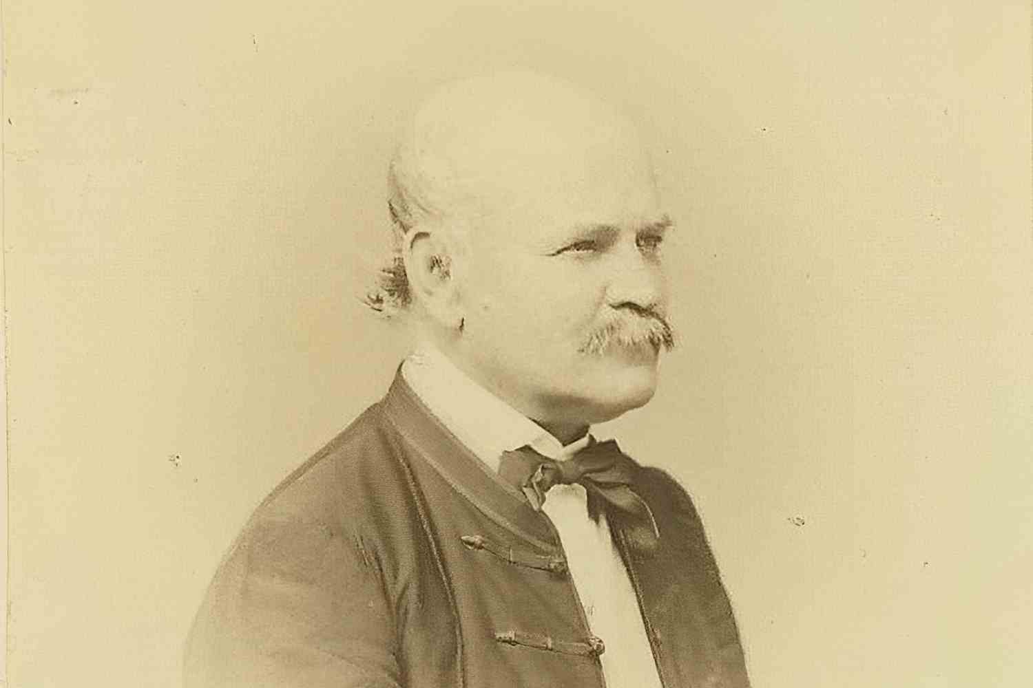 Ignàc Semmelweis