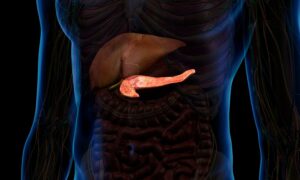 Una posible nueva terapia para el cáncer de páncreas está causando sensación en todo el mundo, pero ¿es realmente la revolución que estábamos esperando?