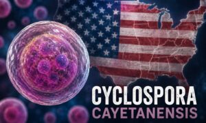 Epidemia de diarrea aguda: casi 3.000 casos sospechosos de ciclosporiasis en EE. UU. (y el parásito podría estar escondido en frutas y verduras)