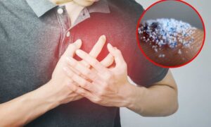 Microplásticos: hay muchos más en la sangre de quien ha sufrido un infarto, según un nuevo estudio italiano
