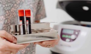 Avance para el Alzheimer: análisis de sangre a partir de los 40 años para quienes ya presentan síntomas, luz verde en EE.UU.
