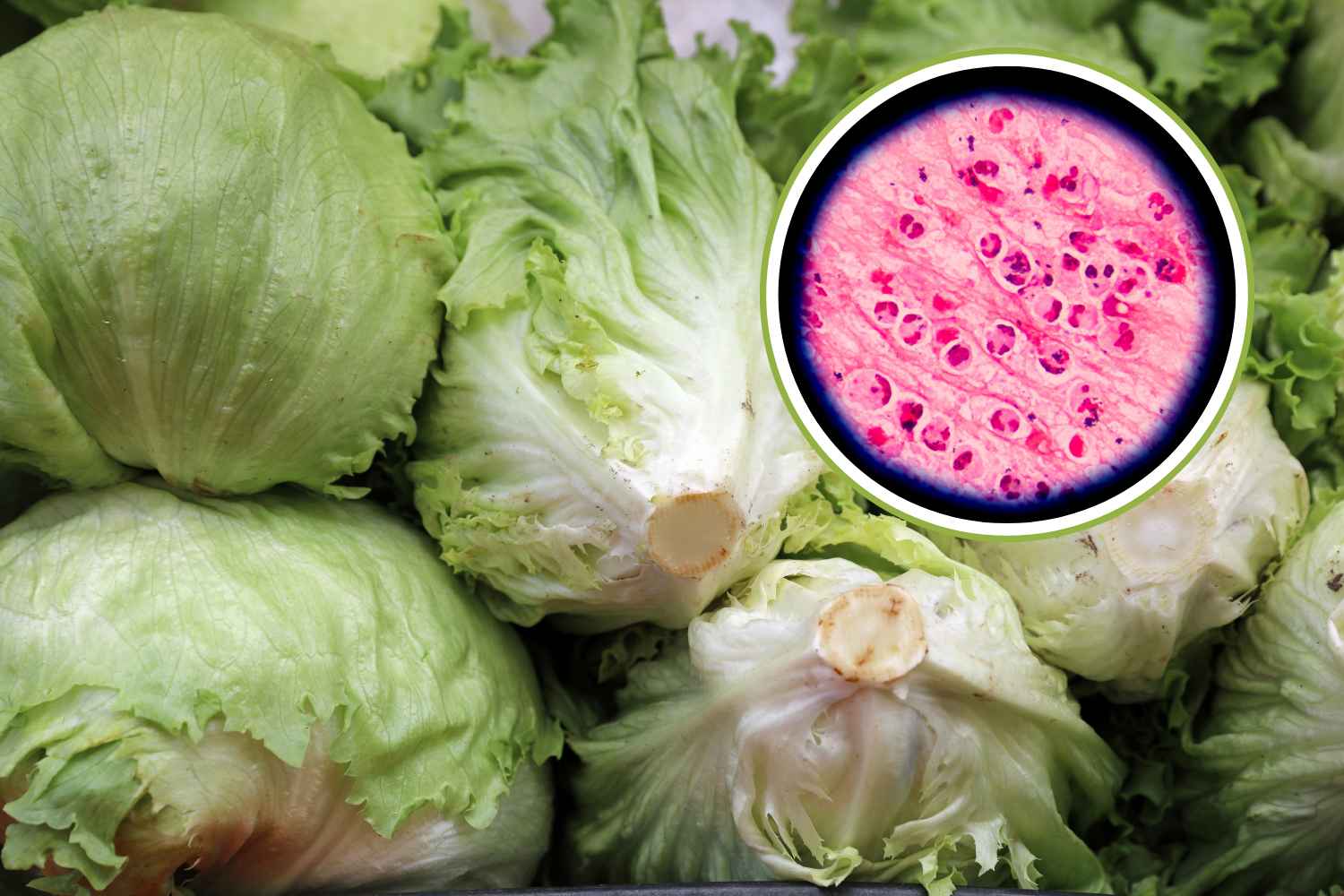 insalata iceberg contaminata Cyclospora