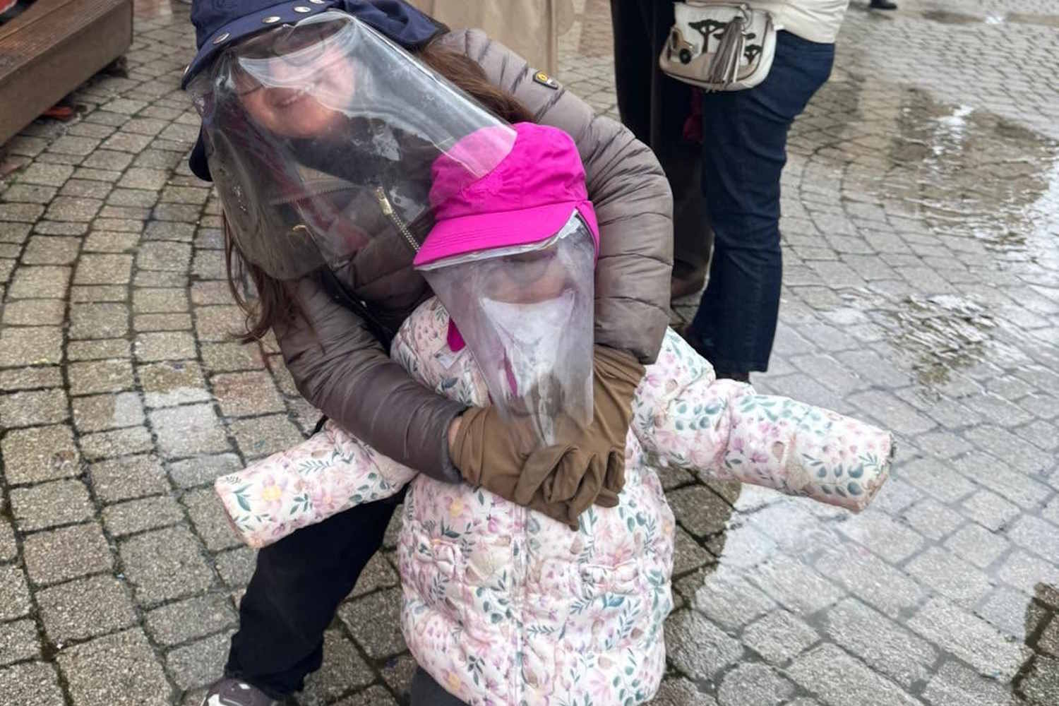 bambini luna xeroderma pigmentoso
